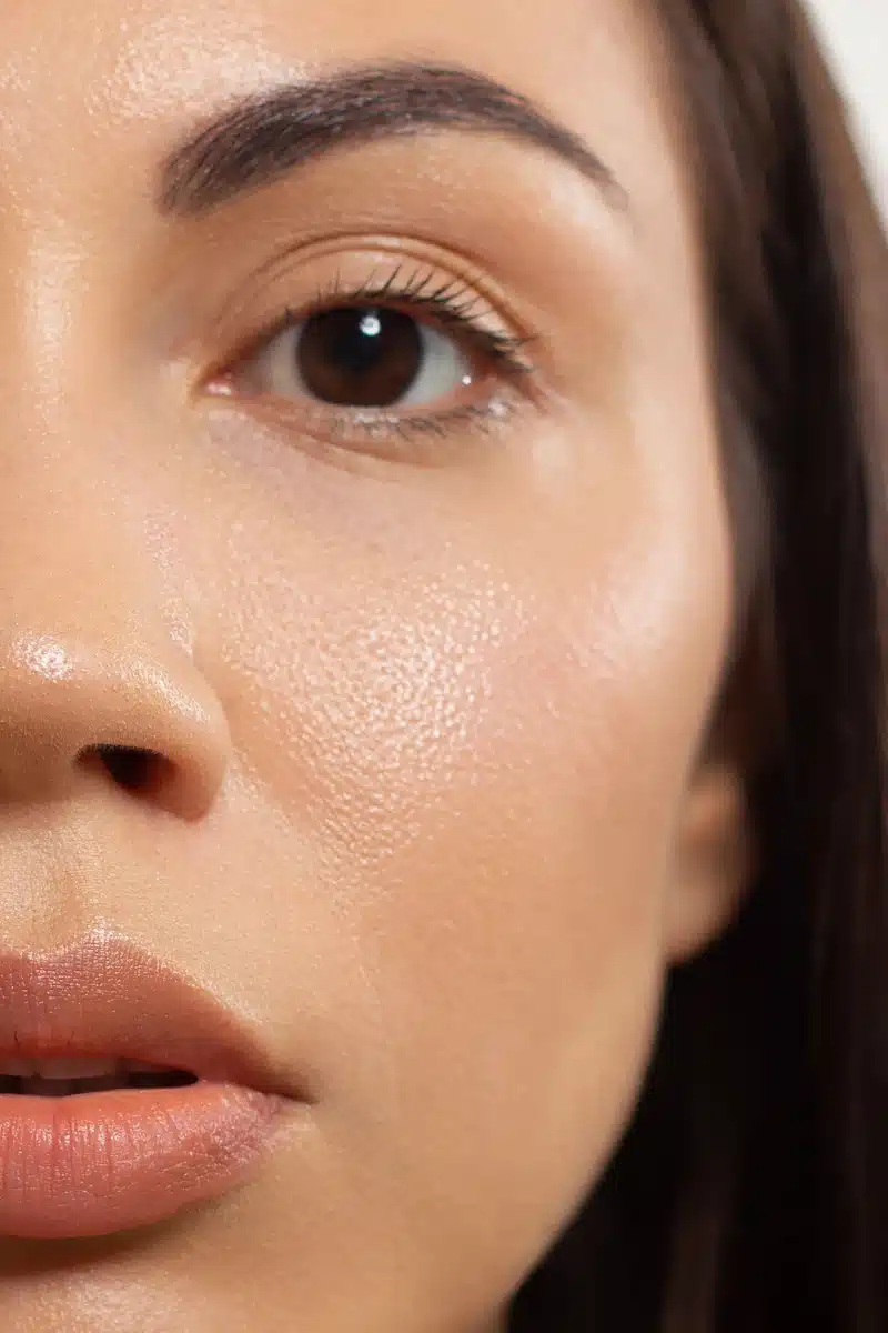 Upper blepharoplasty before and after