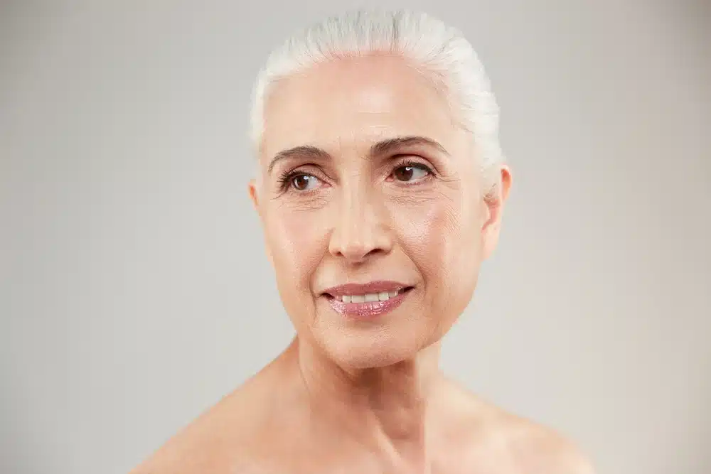 Four-lid blepharoplasty results