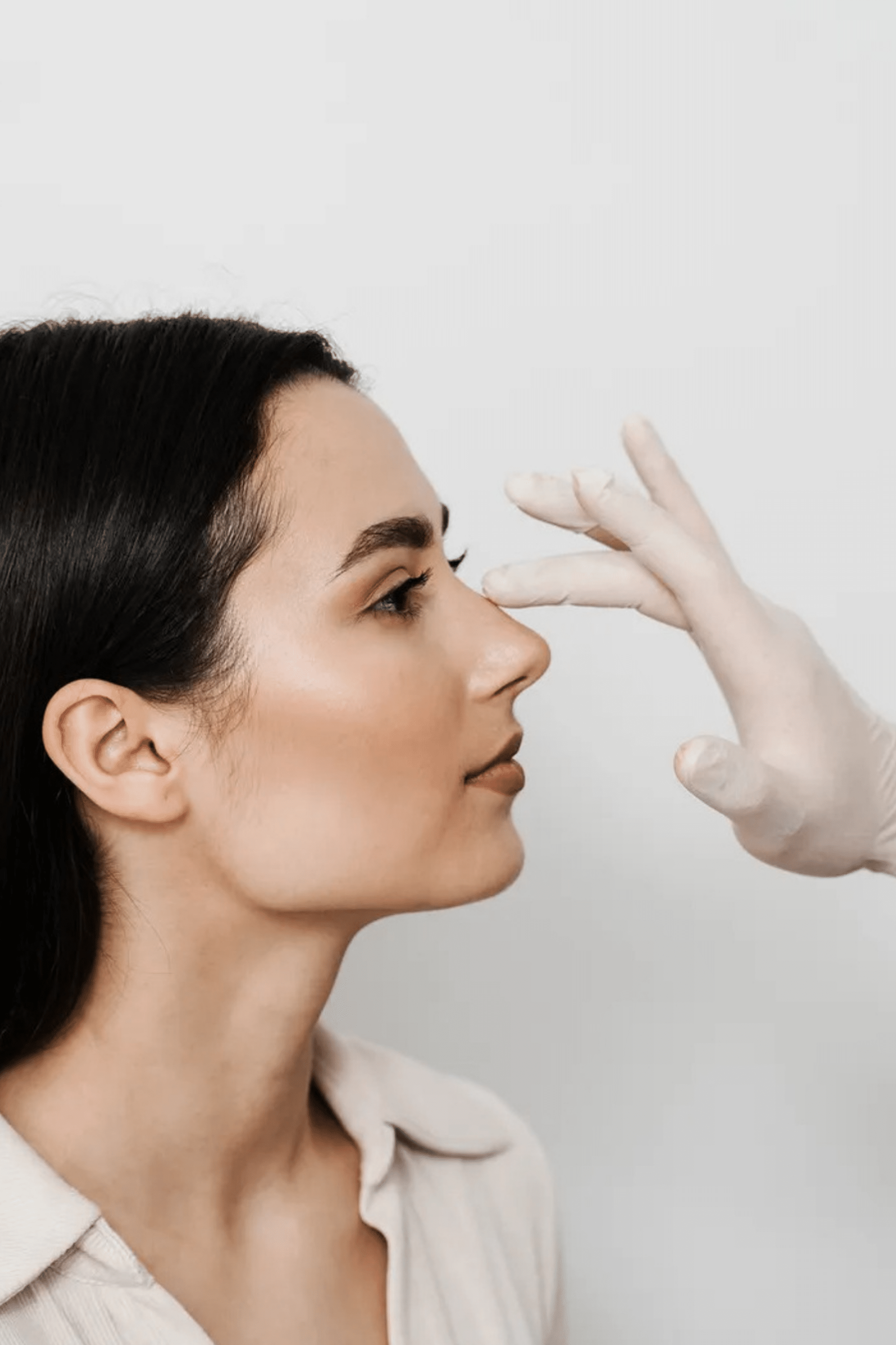Revision rhinoplasty technique diagram