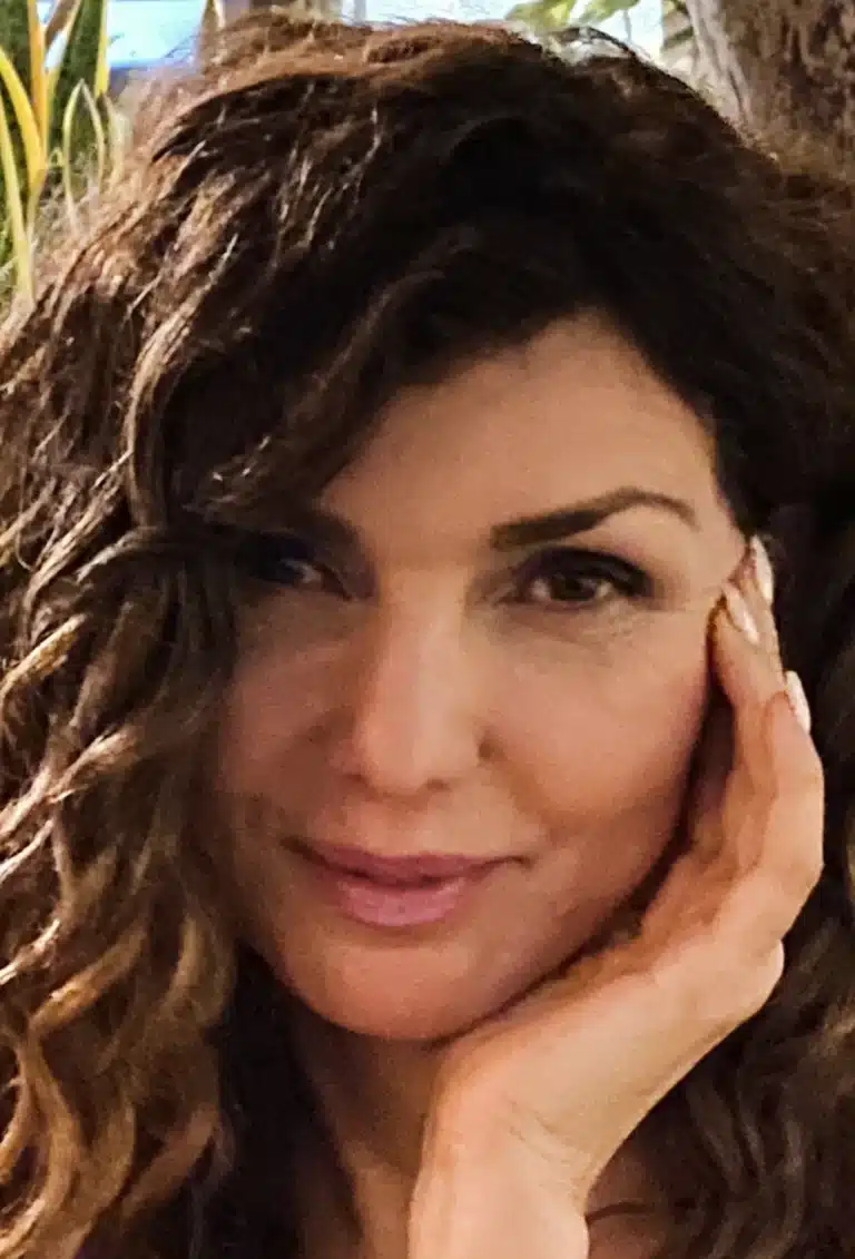 Bellafill Browlift: A Long-Lasting, Non-Surgical Alternative to Brow-Lift Surgery
