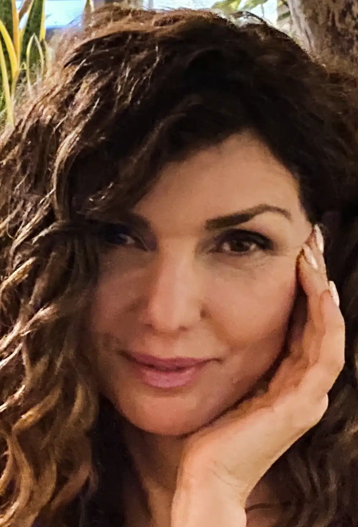 Bellafill Browlift: A Long-Lasting, Non-Surgical Alternative to Brow-Lift Surgery