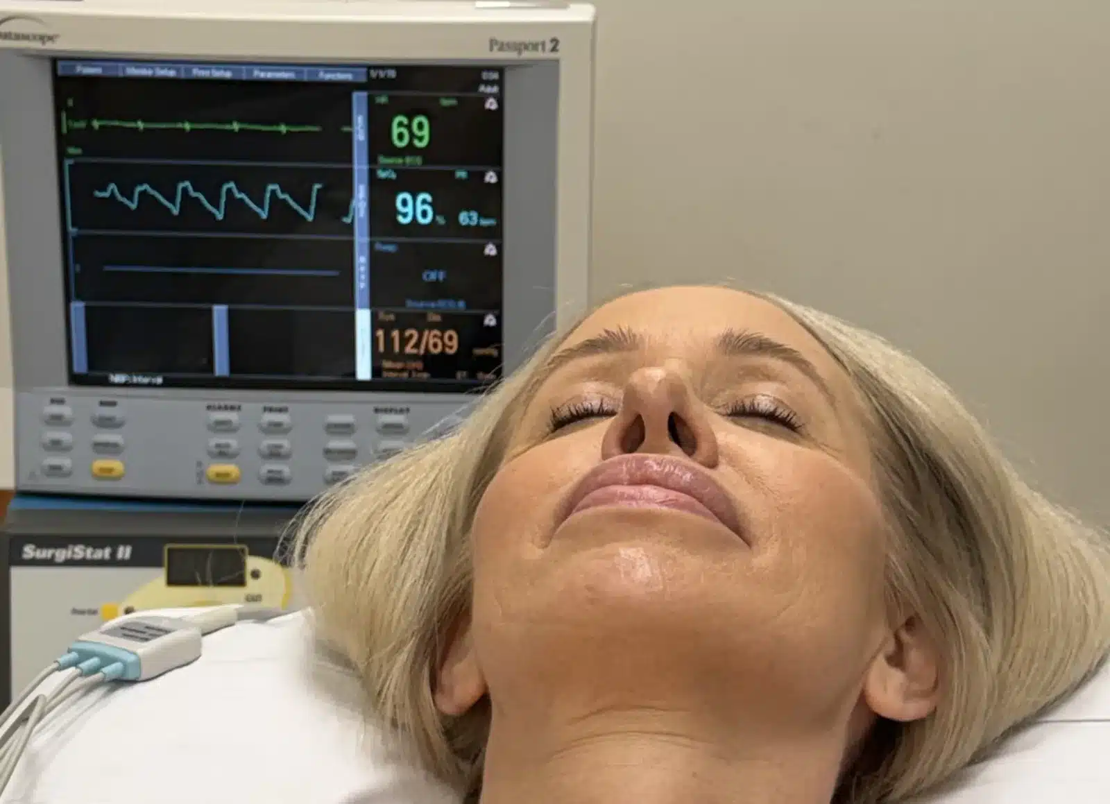 Patient resting comfortably under awake sedation beside a cardiac monitor showing stable vital signs at Dr. Troell's Las Vegas clinic