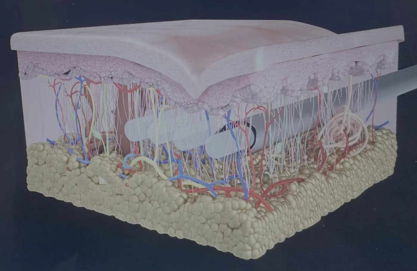 Cross-section model of facial soft-tissue layers including skin, fat, and the fibroseptal network over bone