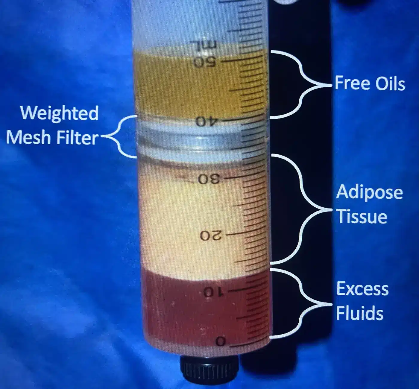 Diagram of harvested fat separated in a filter tube into free oils, adipose tissue, and excess fluids during centrifugation-filtration processing
