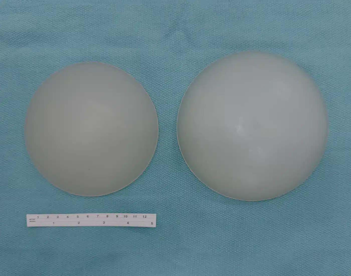 Two solid silicone gluteal implants of different sizes on a sterile field with a measuring scale