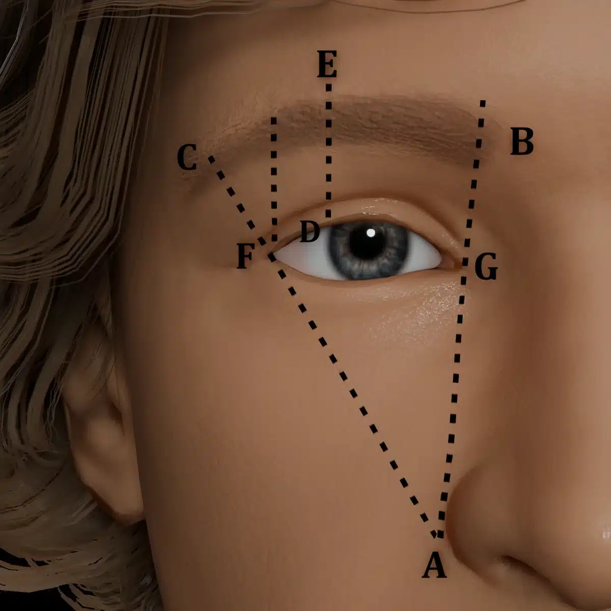 3D facial analysis render showing brow measurement vectors used in aesthetic surgical planning