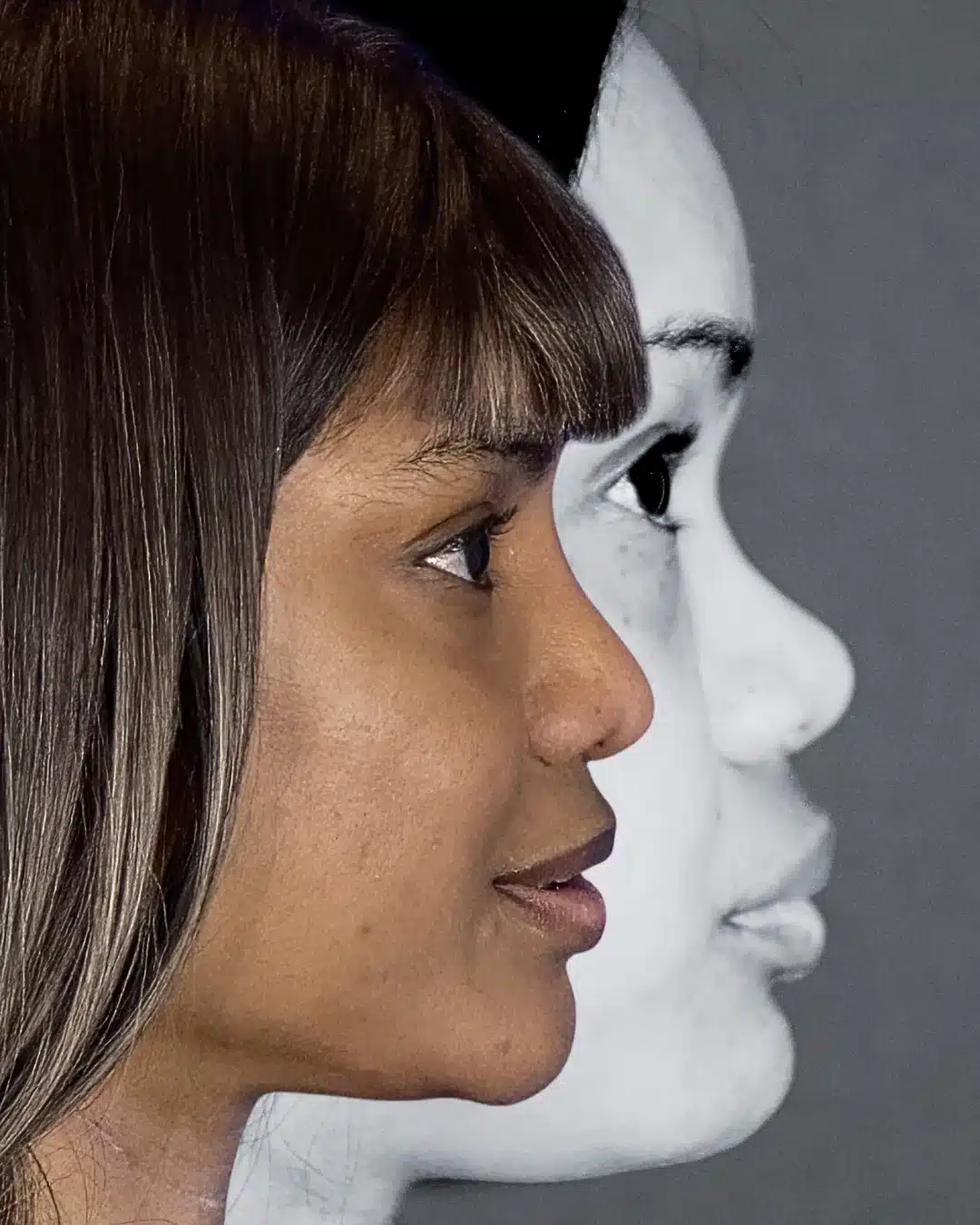 Profile before-and-after overlay: color after-photo in front of the grayscale before-photo showing the raised nasal bridge from implant and cartilage graft &mdash; actual patient of Dr. Robert Troell, Las Vegas