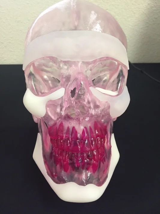 Custom Facial Implants: Are They Right for You?